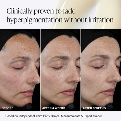 Pro C Serum Brightening Solution