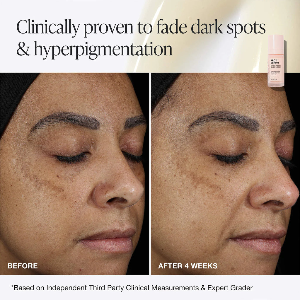 Pro C Serum Brightening Solution