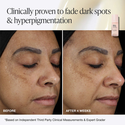 Pro C Serum Brightening Solution