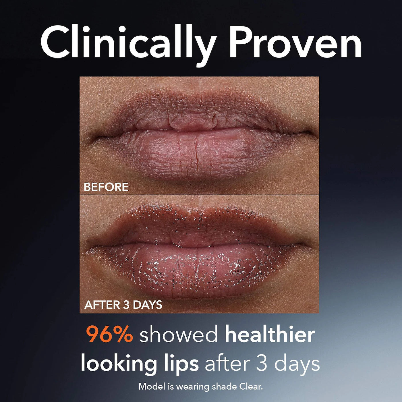 Mini DermInfusions™ Plump + Repair Lip Treatment