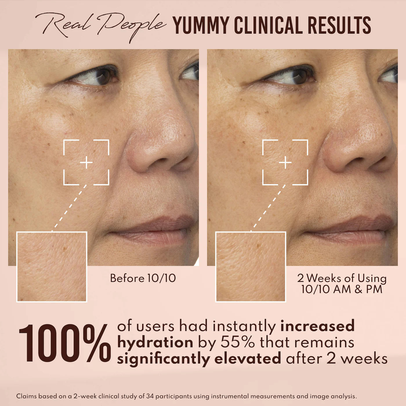 Yummy Skin 10/10 Barrier Boost Plumping Serum