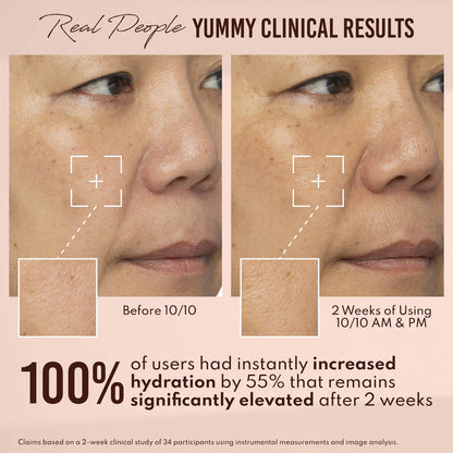 Yummy Skin 10/10 Barrier Boost Plumping Serum
