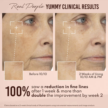 Yummy Skin 10/10 Barrier Boost Plumping Serum