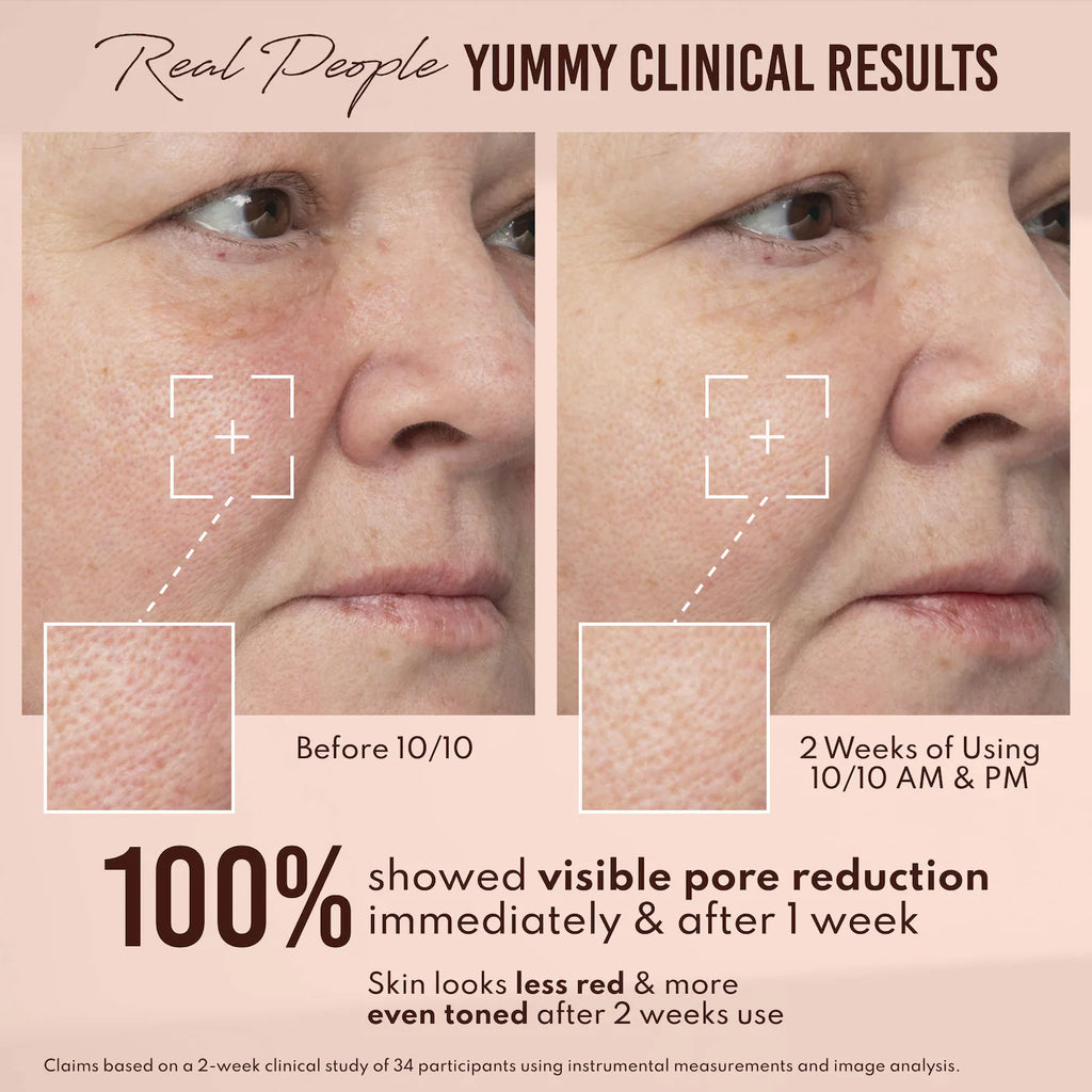 Yummy Skin 10/10 Barrier Boost Plumping Serum