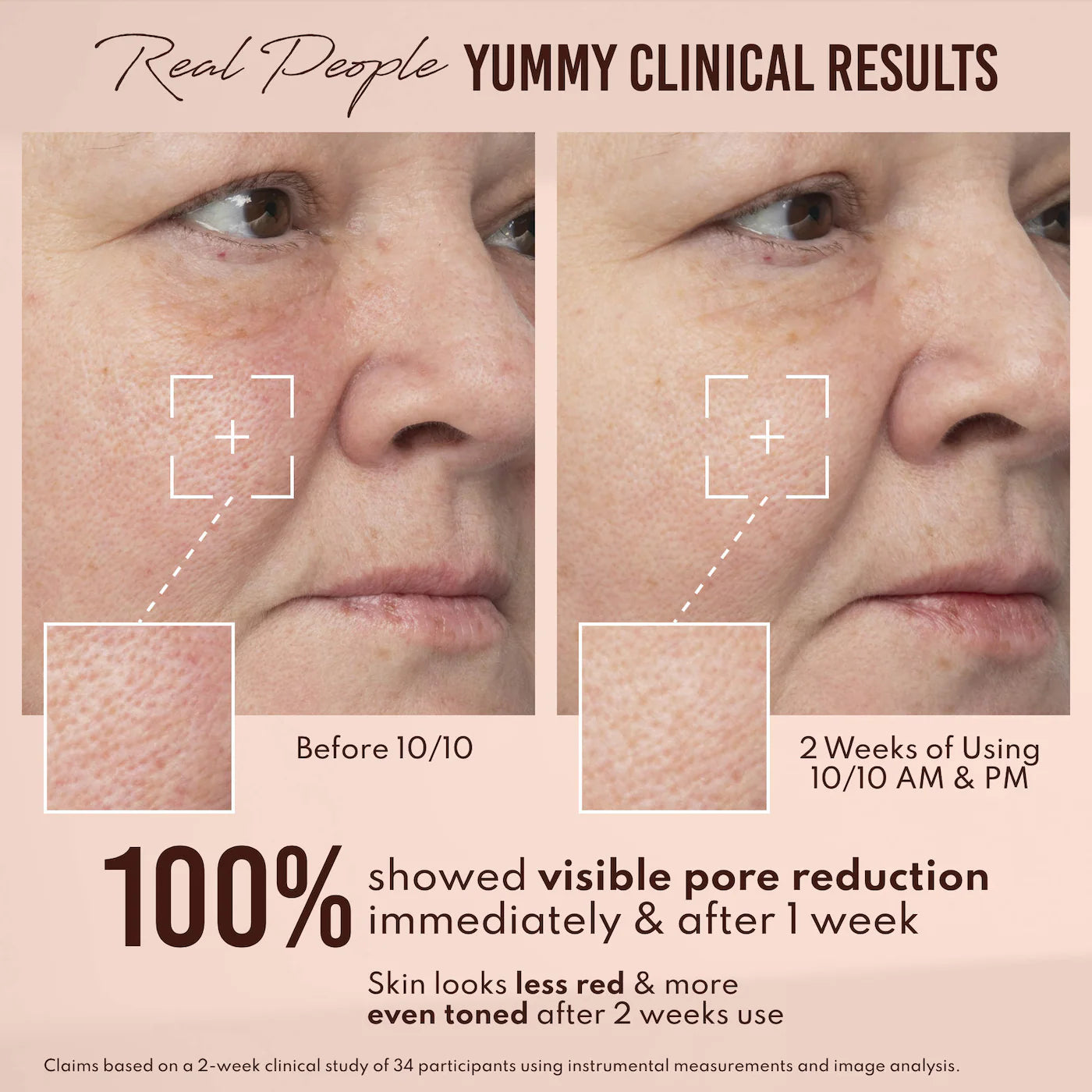 Yummy Skin 10/10 Barrier Boost Plumping Serum