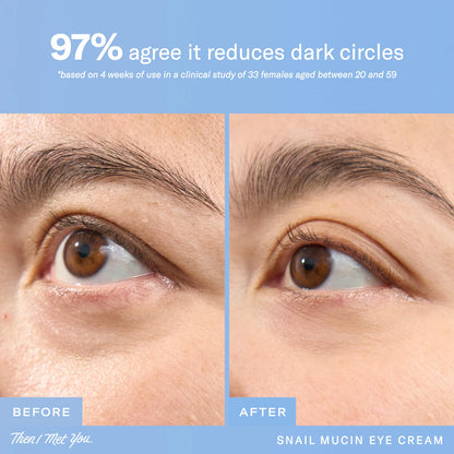 Snail Mucin Eye Cream