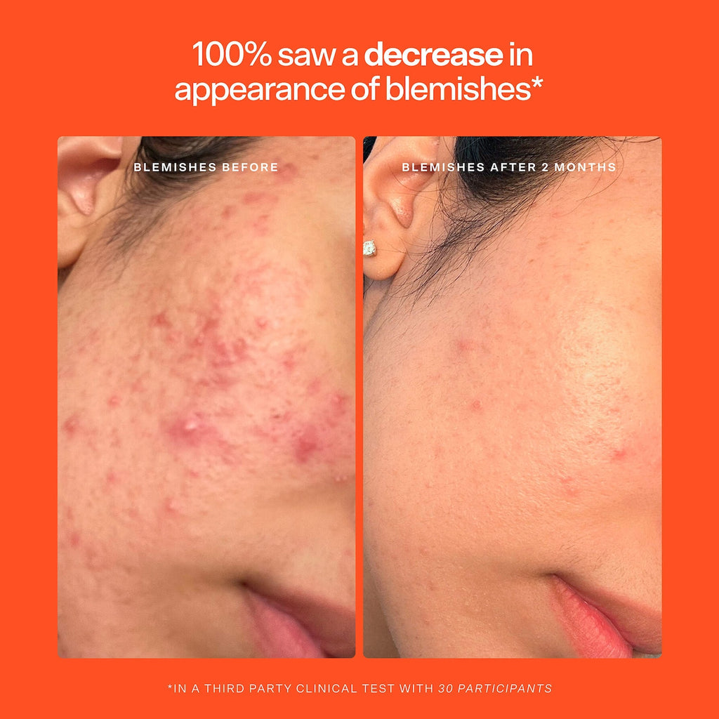 SOS Hypochlorous Acid Spray Duo Skincare Set