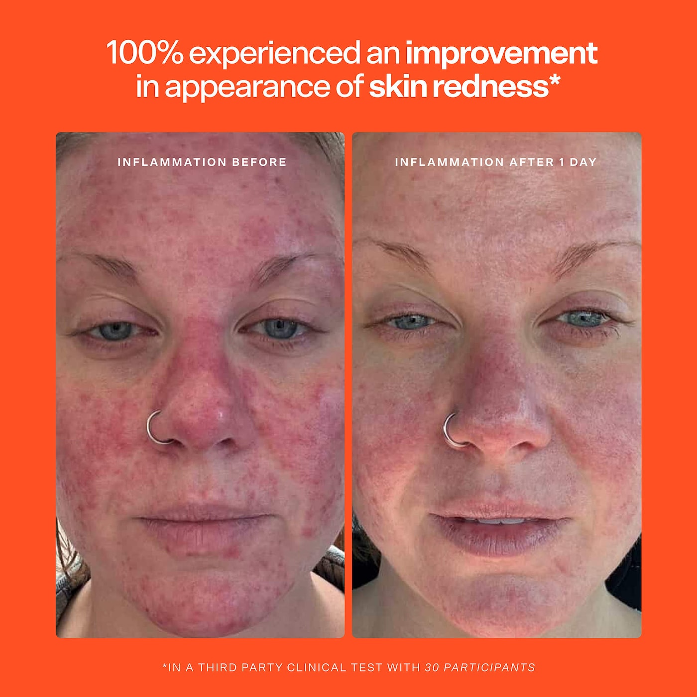 SOS Hypochlorous Acid Spray Duo Skincare Set