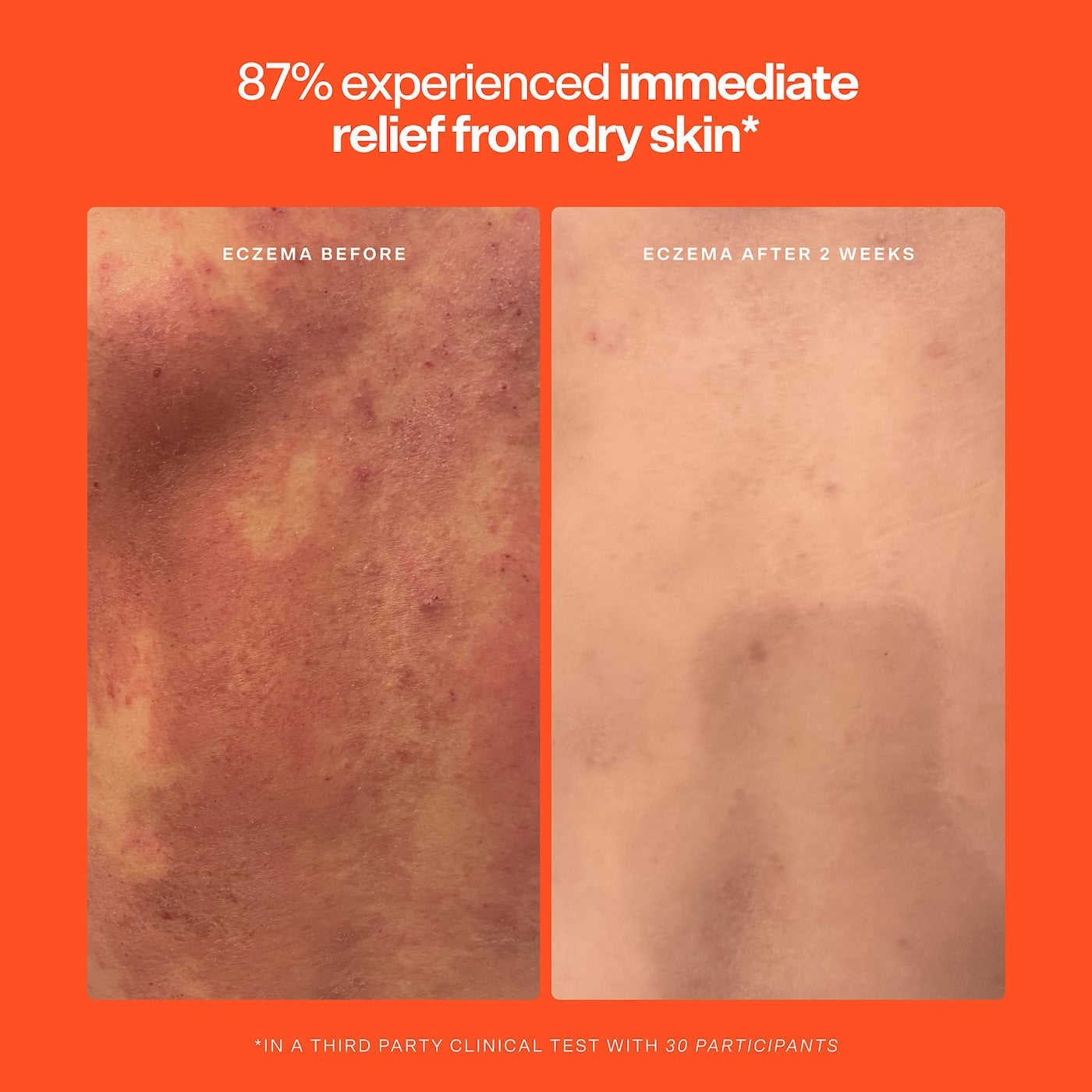 SOS Hypochlorous Acid Spray Duo Skincare Set