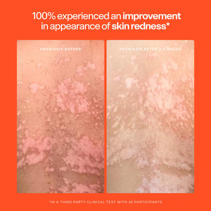 SOS Hypochlorous Acid Spray Duo Skincare Set