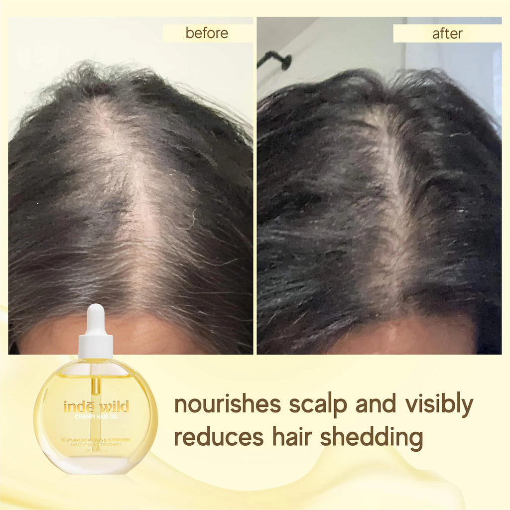 Champi Hair & Scalp Pre-Wash Oil