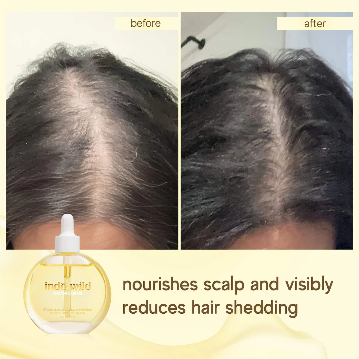 Champi Hair & Scalp Pre-Wash Oil