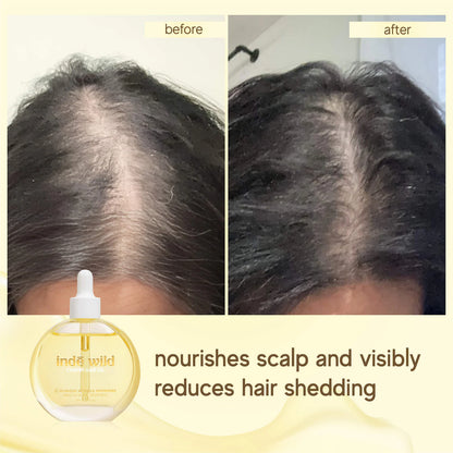 Champi Hair & Scalp Pre-Wash Oil