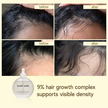 Moonlight Hair Growth Scalp Serum