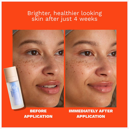 Vitamin C 15% Refillable Treatment Serum to Brighten and Smooth