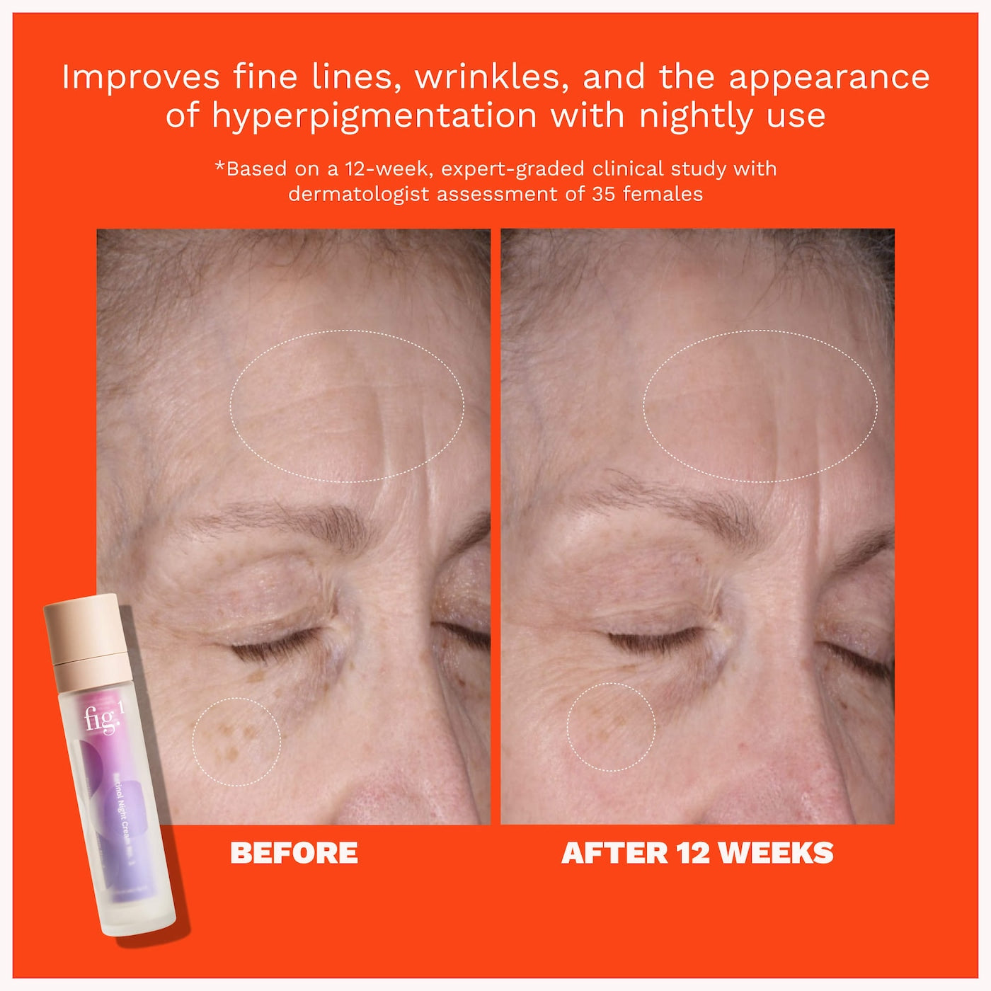 0.15% Retinol Refillable Night Cream for Fine Lines + Wrinkles