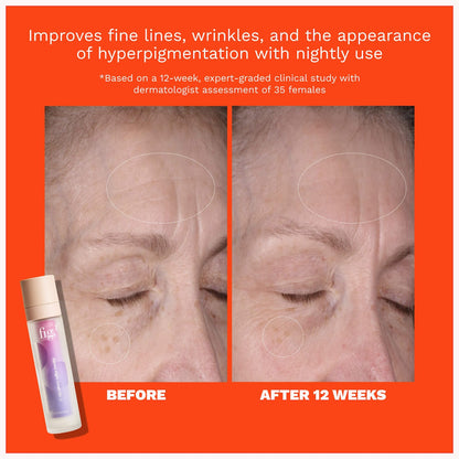0.15% Retinol Refillable Night Cream for Fine Lines + Wrinkles