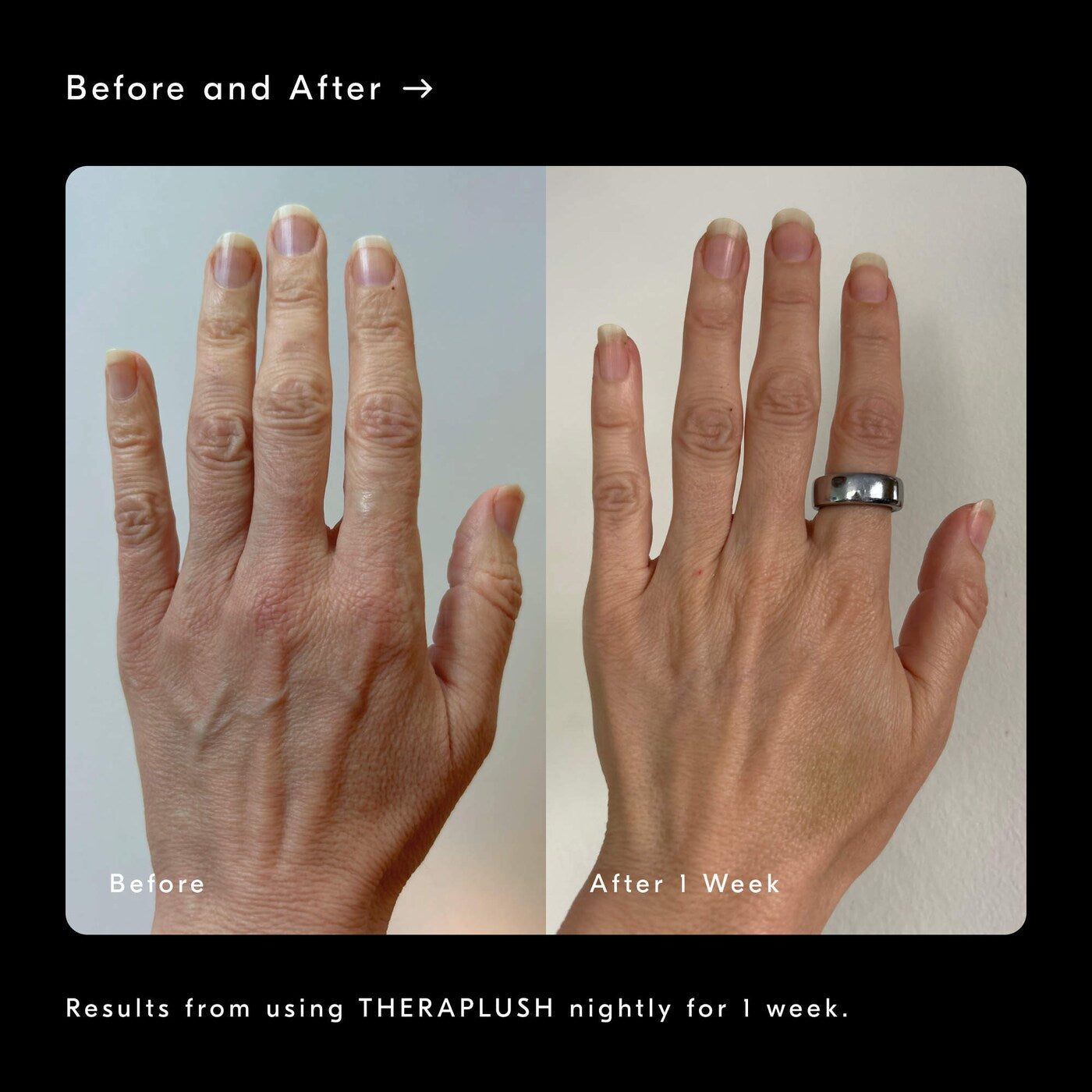 Theraplush Refillable Overnight Retinol Hand Repair Cream
