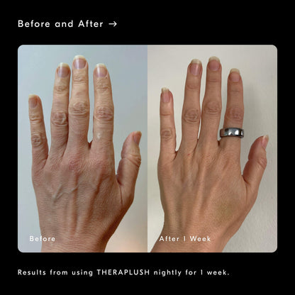 Theraplush Refillable Overnight Retinol Hand Repair Cream