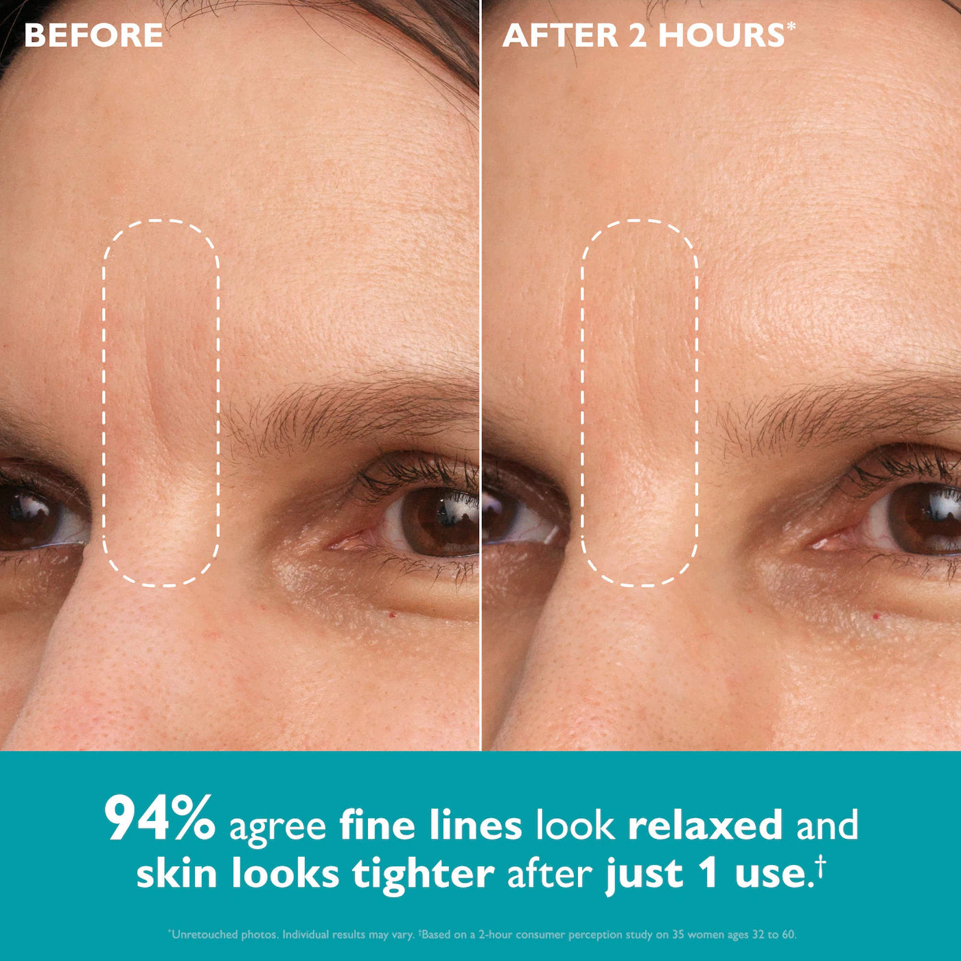 Peptide Skinjection™ Peptide-Infused Face & Eye Tape
