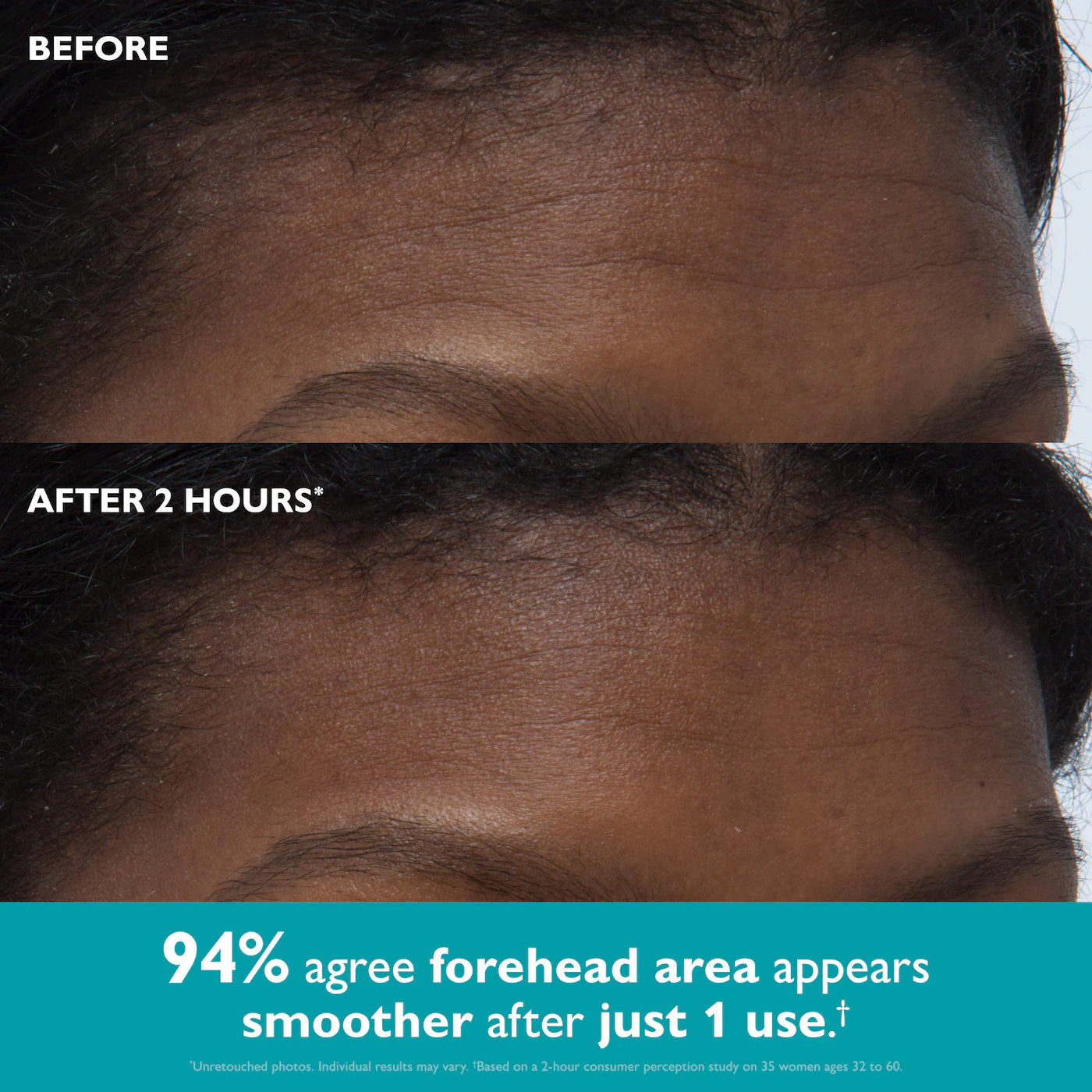 Peptide Skinjection™ Peptide-Infused Face & Eye Tape