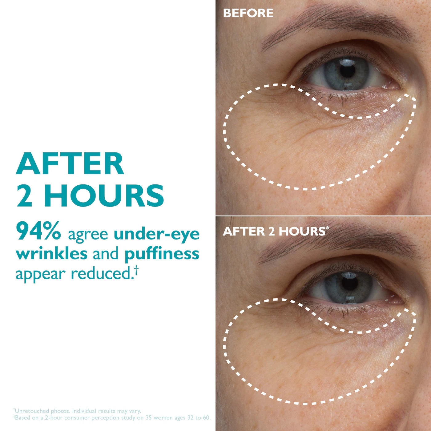 Peptide Skinjection™ Peptide-Infused Face & Eye Tape
