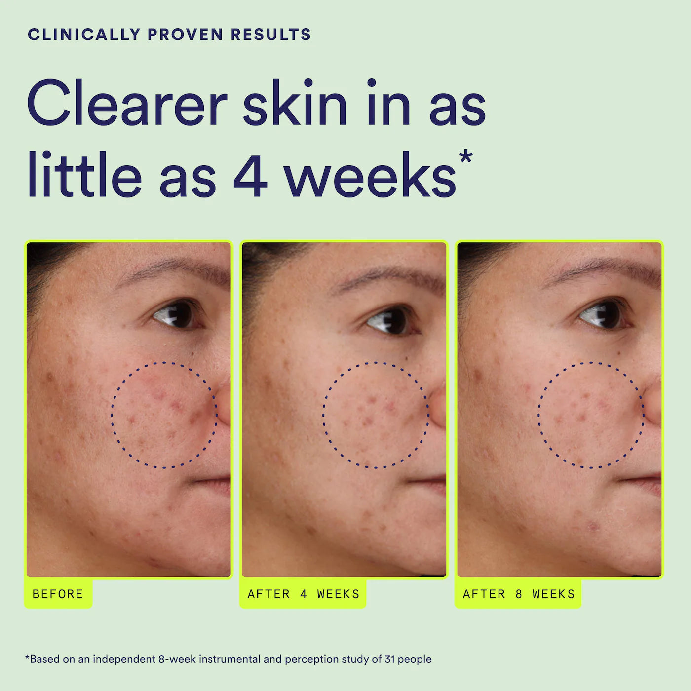 Continuum Daily Multi-Clarifying Treatment