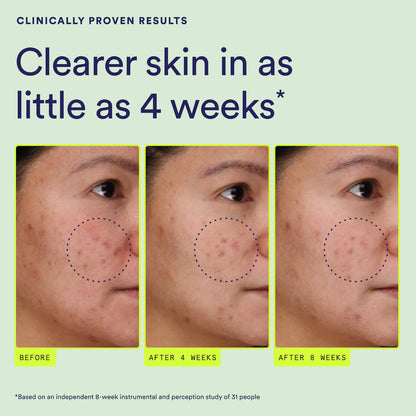 Continuum Daily Multi-Clarifying Treatment