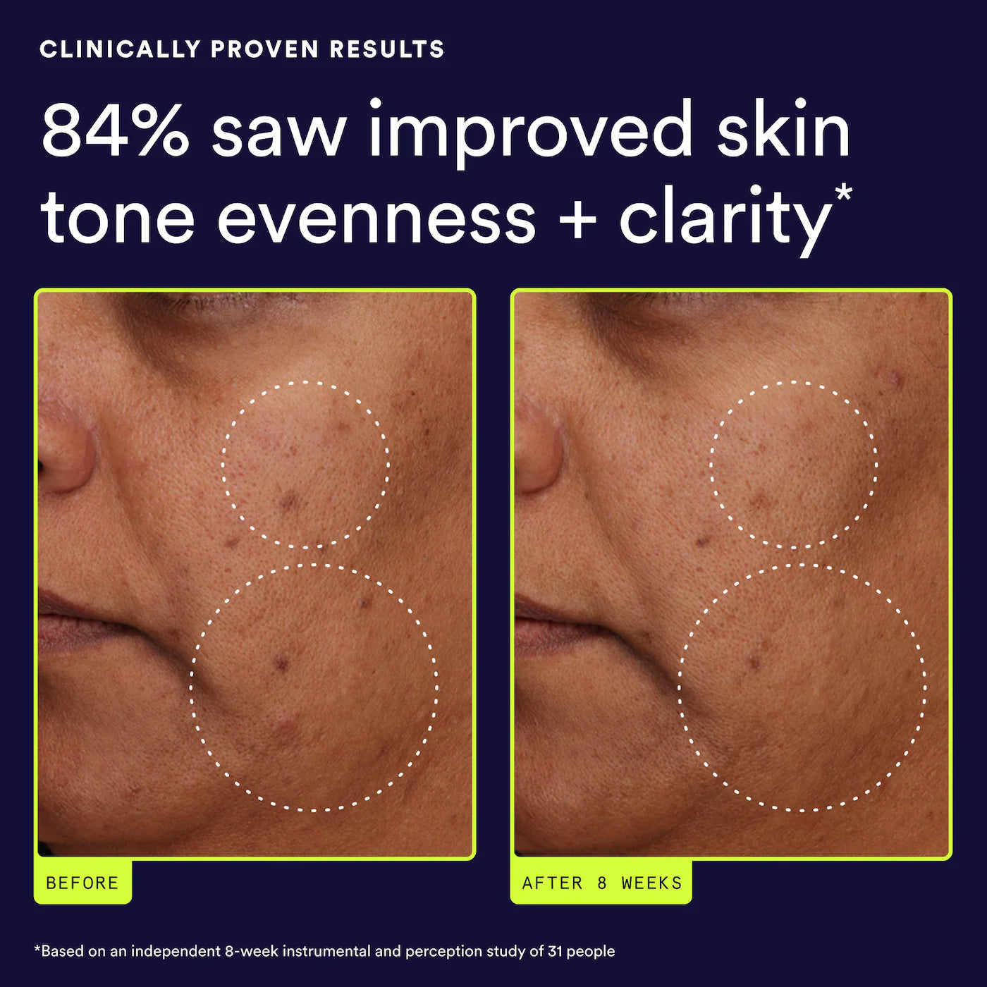 Continuum Daily Multi-Clarifying Treatment