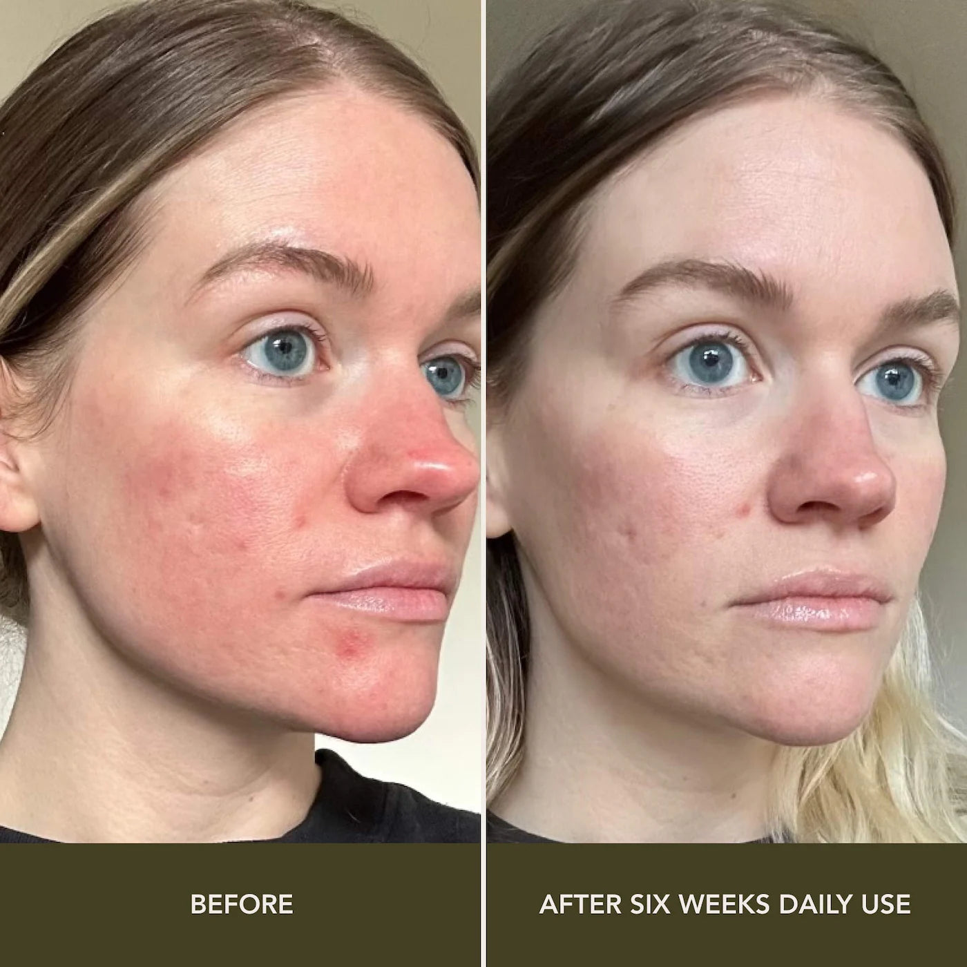Leche De Guava Resurfacing Toner