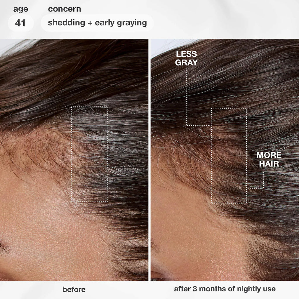 FutureIQ™ Hair Longevity Serum for Graying, Thinning, & Scalp Aging