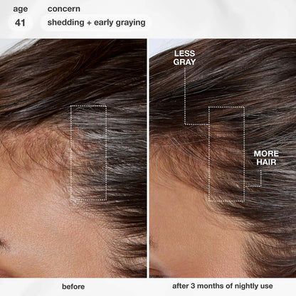 FutureIQ™ Hair Longevity Serum for Graying, Thinning, & Scalp Aging