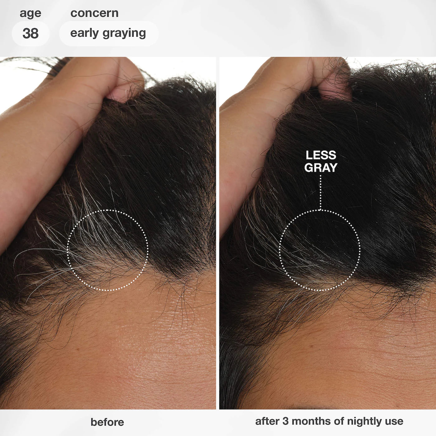 FutureIQ™ Hair Longevity Serum for Graying, Thinning, & Scalp Aging