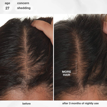 FutureIQ™ Hair Longevity Serum for Graying, Thinning, & Scalp Aging