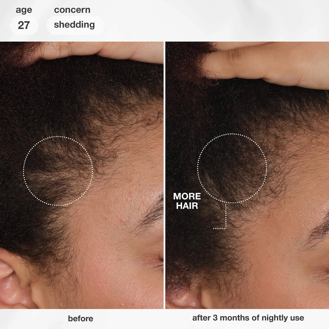 FutureIQ™ Hair Longevity Serum for Graying, Thinning, & Scalp Aging