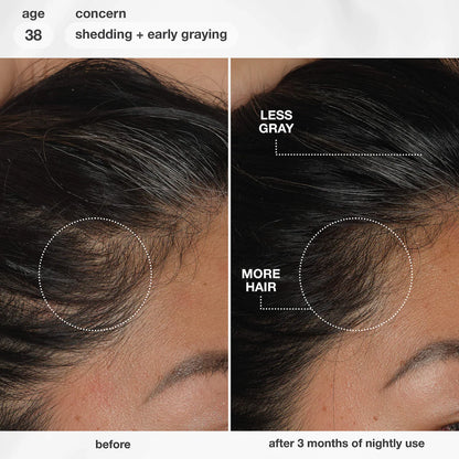 FutureIQ™ Hair Longevity Serum for Graying, Thinning, & Scalp Aging