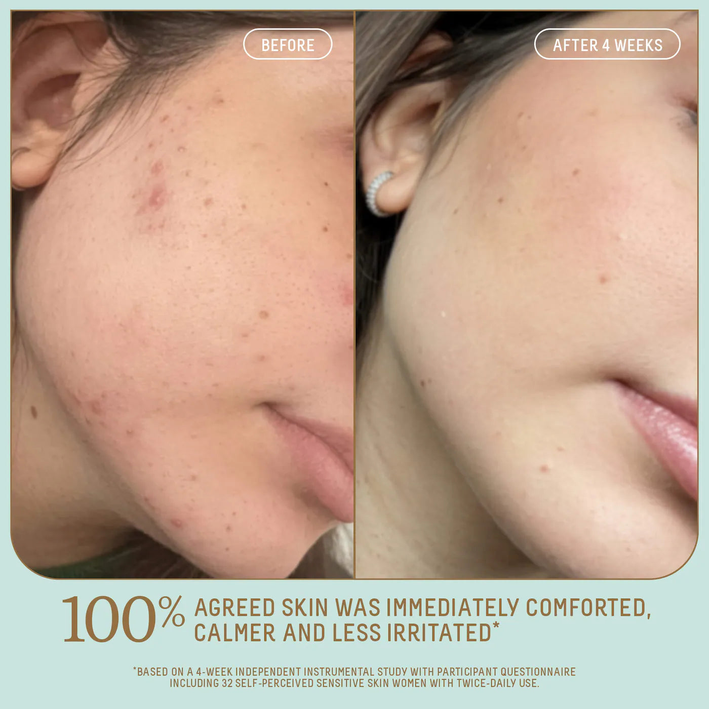 Probiotic Gel Lightweight Non-Comedogenic Moisturizer with Glycerin + Squalane