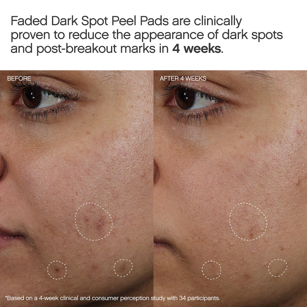 Faded Brightening Peel Pads for Dark Spots