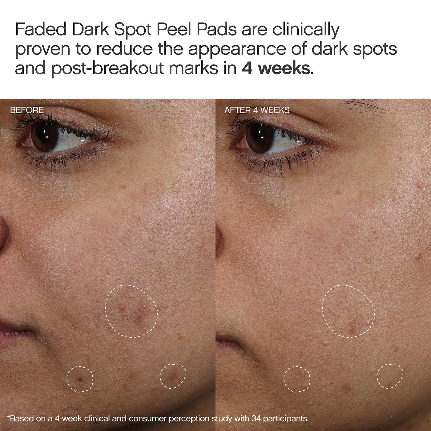 Faded Brightening Peel Pads for Dark Spots