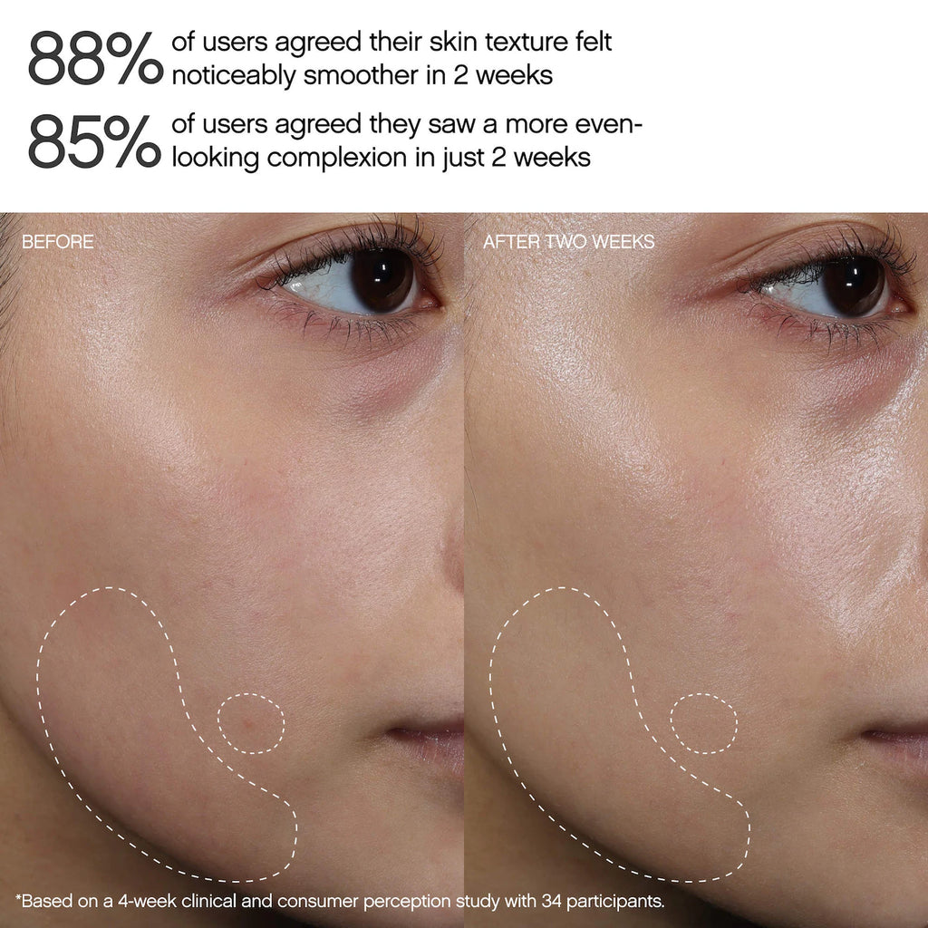 Faded Brightening Peel Pads for Dark Spots