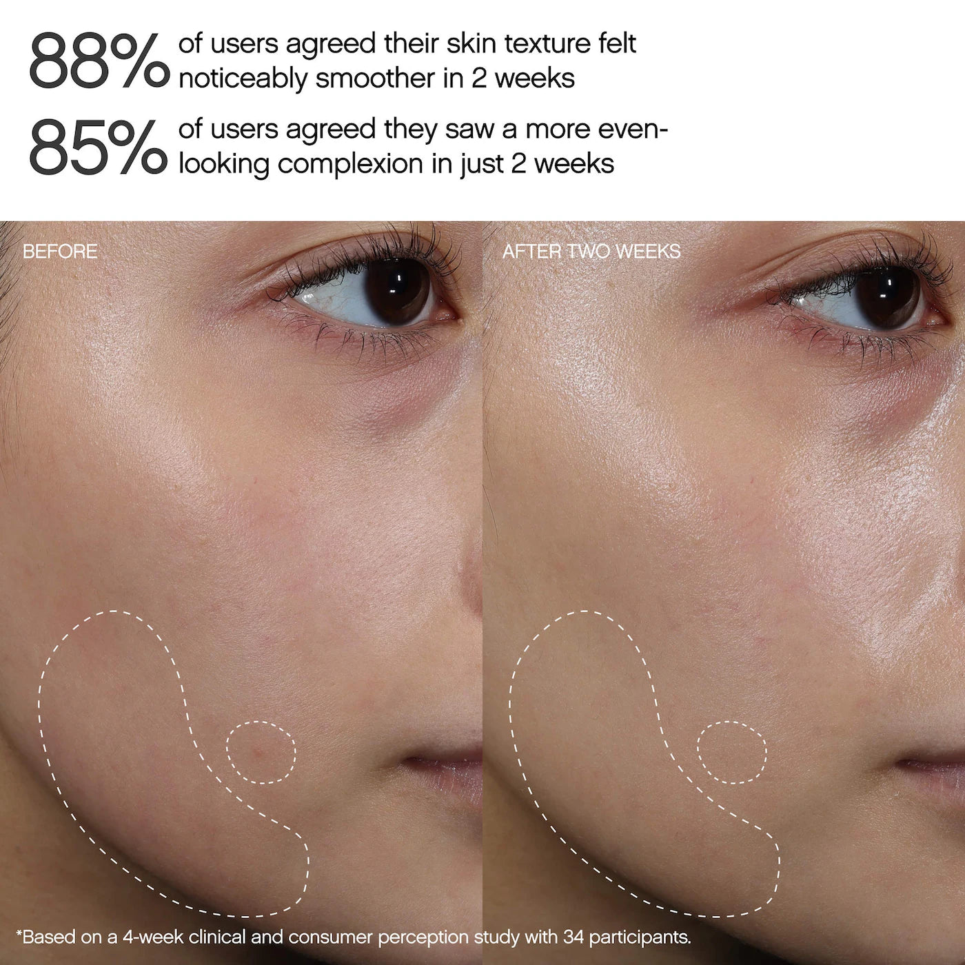 Faded Brightening Peel Pads for Dark Spots