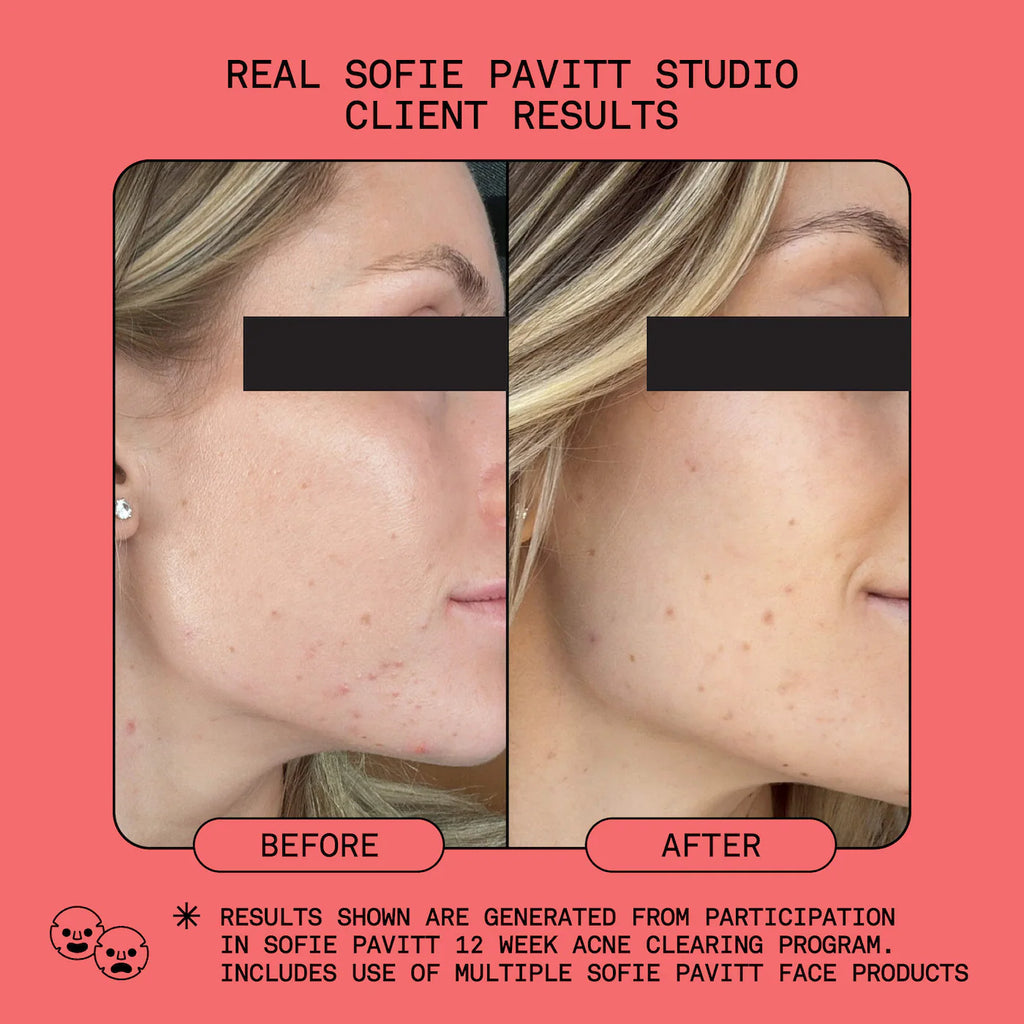 Studio-Smooth Microdermabrasion Exfoliating Scrub Treatment