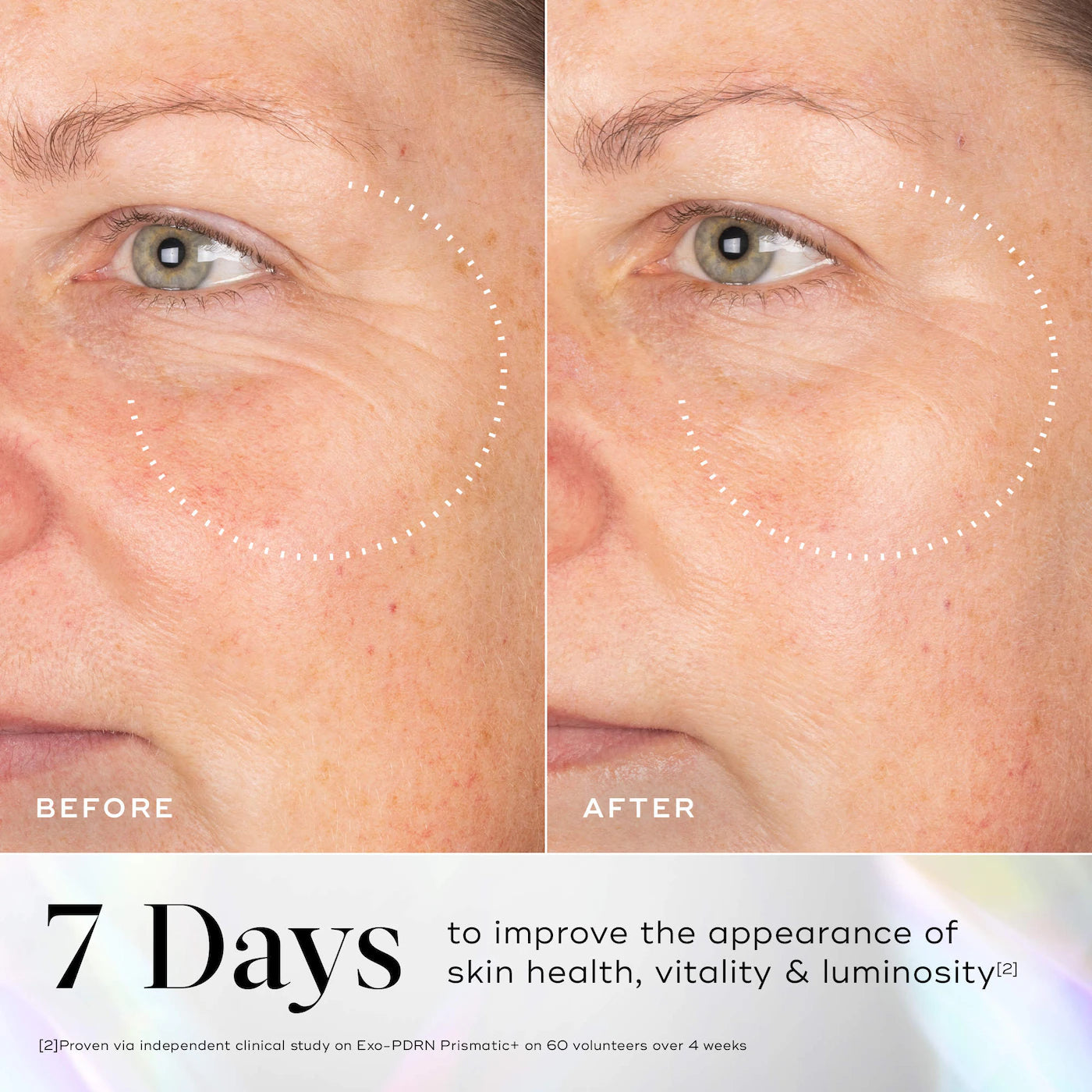 Exo-PDRN Prismatic+ Vegan PDRN Serum
