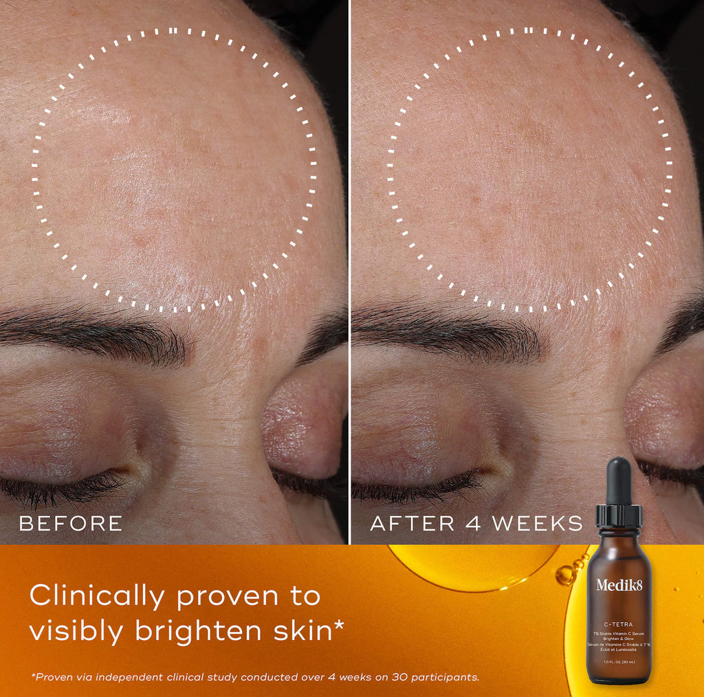 C-Tetra 7% Stabilized Vitamin C Brightening Serum for Sensitive Skin