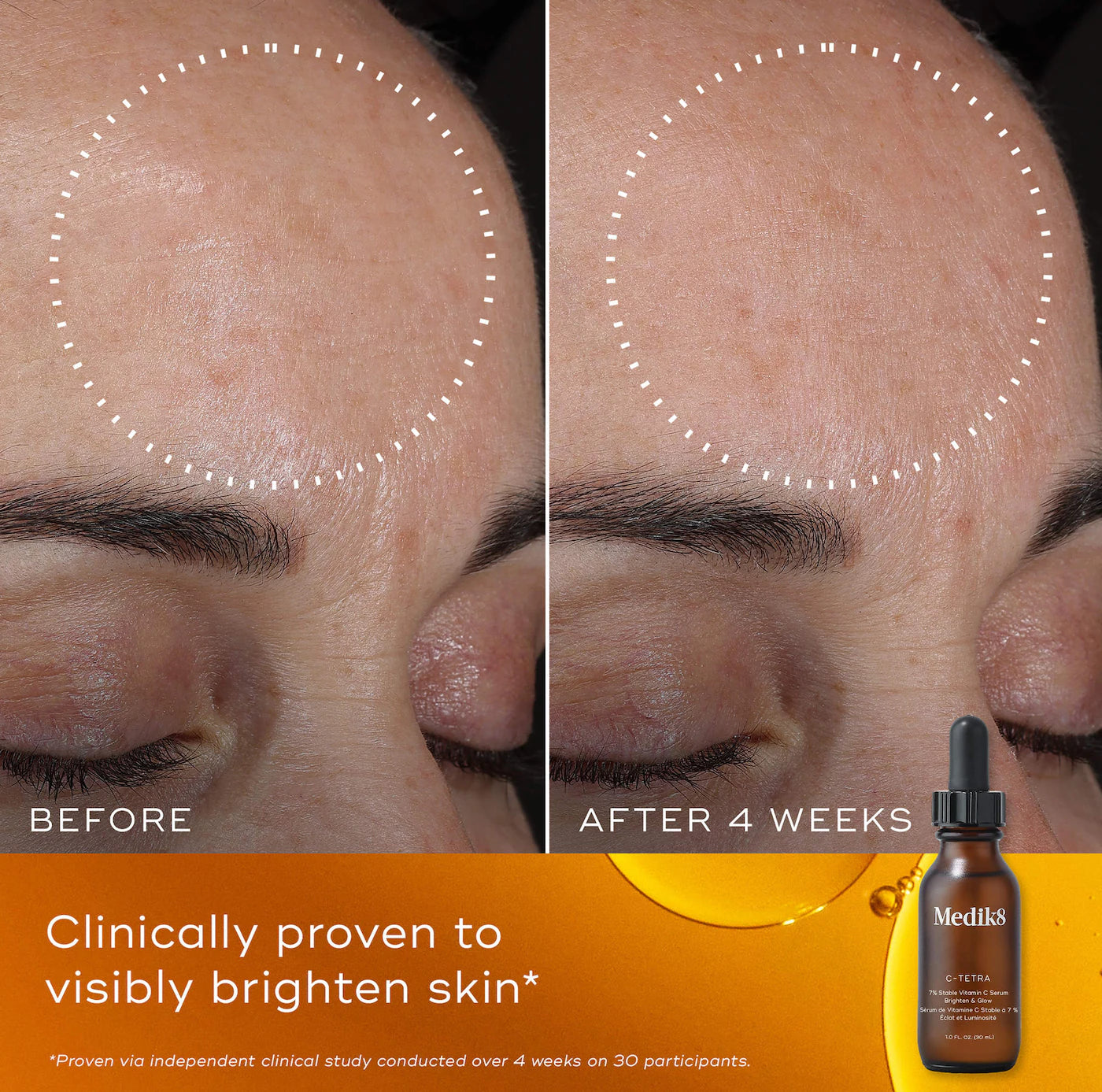 C-Tetra 7% Stabilized Vitamin C Brightening Serum for Sensitive Skin