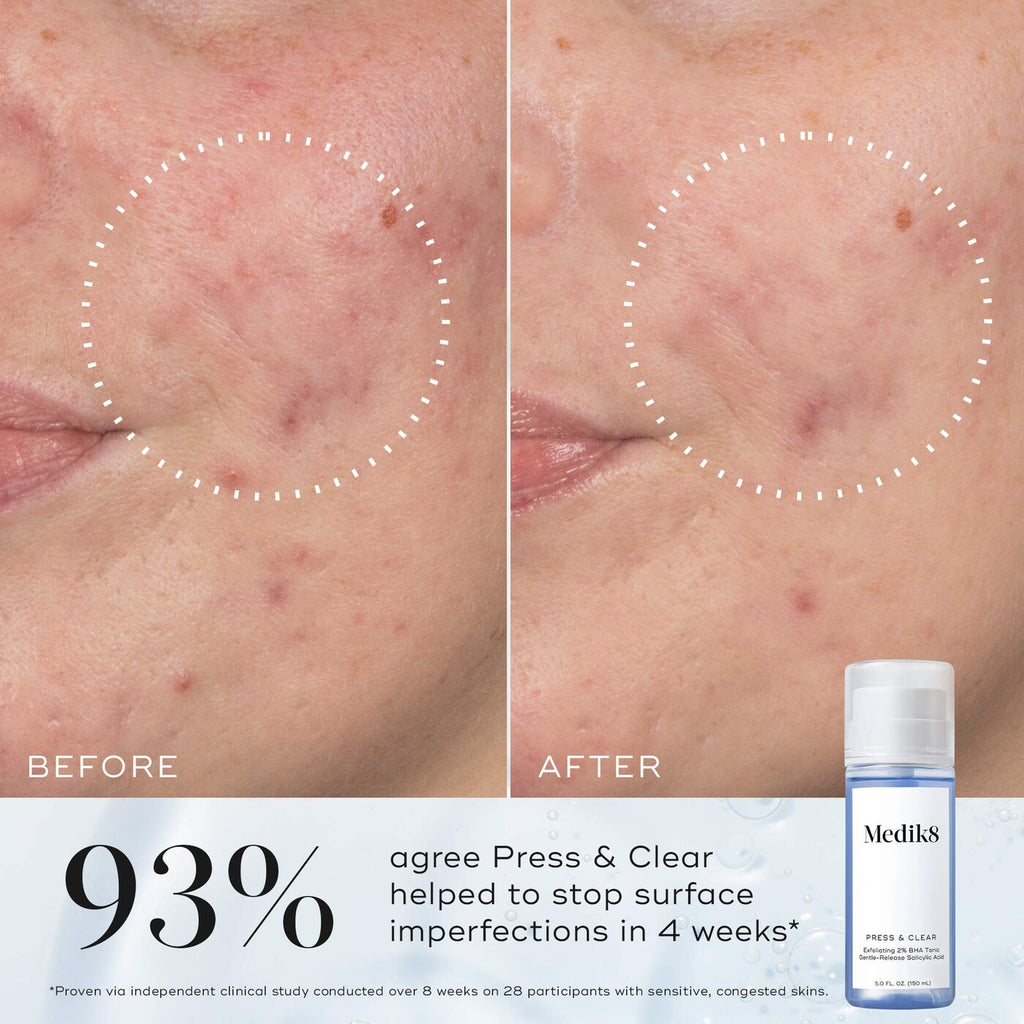 Press & Clear Gentle Exfoliating Salicylic Acid BHA Toner