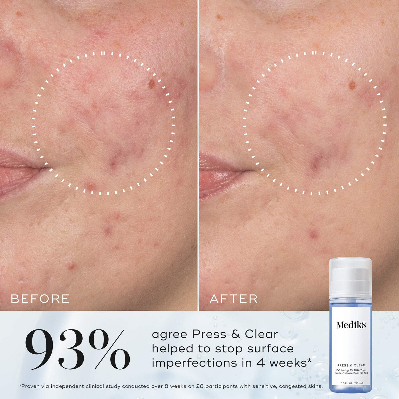 Press & Clear Gentle Exfoliating Salicylic Acid BHA Toner