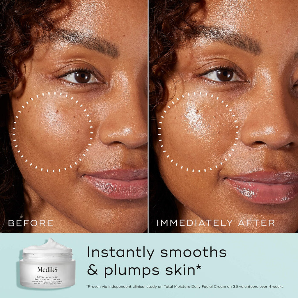 Total Moisture Daily Facial Cream Moisturizer