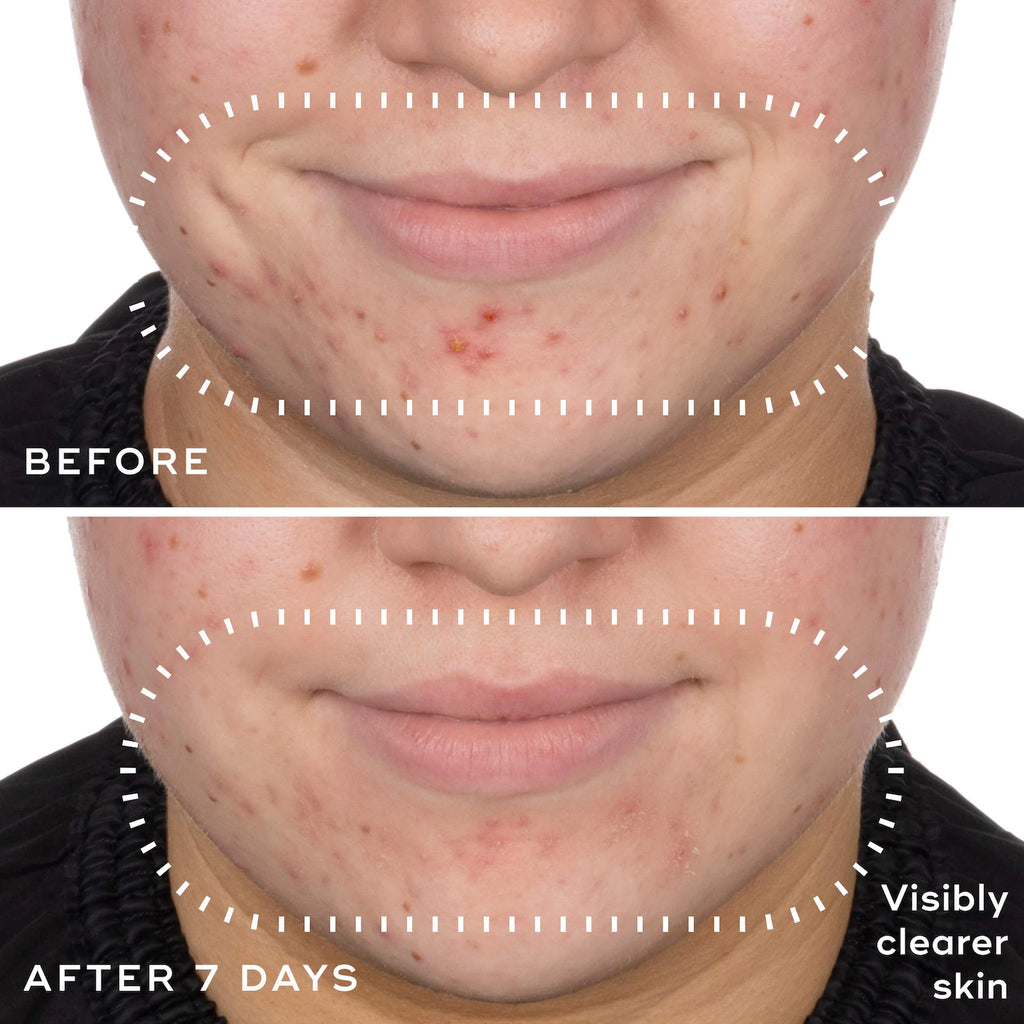 Niacinamide Peptides Balancing & Pore-Refining Serum
