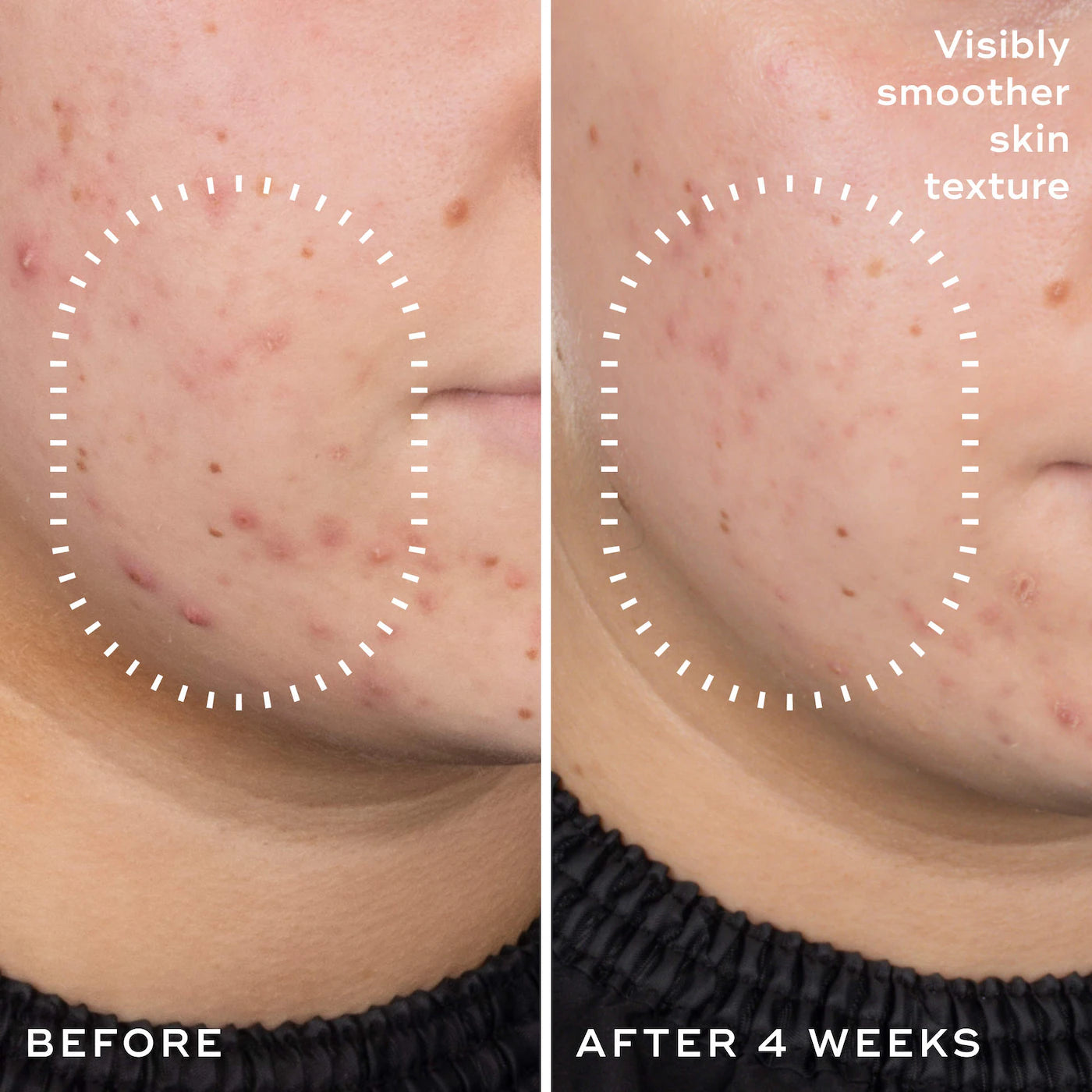 Niacinamide Peptides Balancing & Pore-Refining Serum